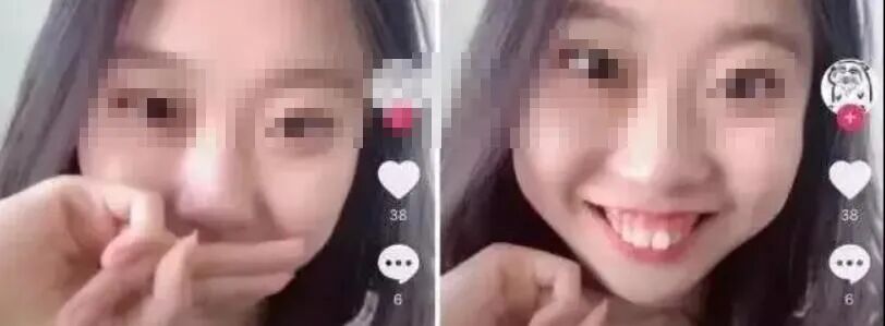 昨天戴牙套时间不够，今天能加班弥补吗？