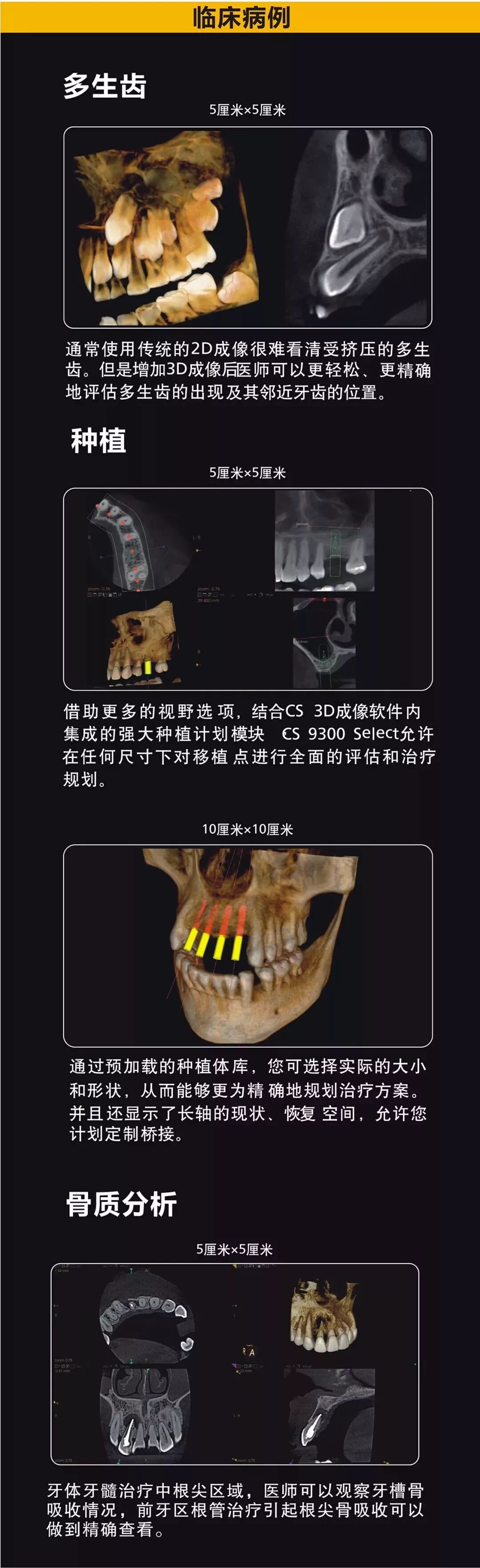 什么是平板探测器浅谈CBCT成像的关键：平板探测器，选非晶硅还是CMOS？_https://www.jmylbn.com_新闻资讯_第7张