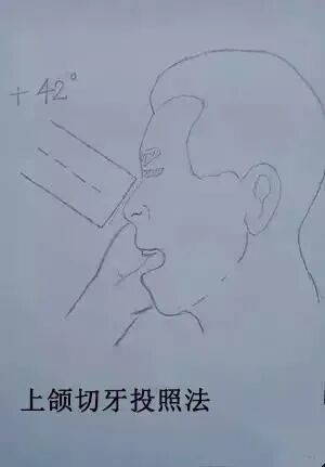 x光机为什么X光机的拍摄技术与心得，牙医和护士都要懂！_https://www.jmylbn.com_新闻资讯_第10张