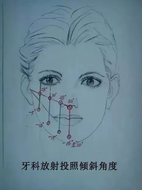 x光机为什么X光机的拍摄技术与心得，牙医和护士都要懂！_https://www.jmylbn.com_新闻资讯_第9张