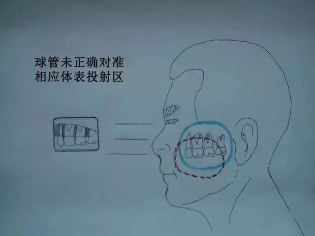 x光机为什么X光机的拍摄技术与心得，牙医和护士都要懂！_https://www.jmylbn.com_新闻资讯_第13张