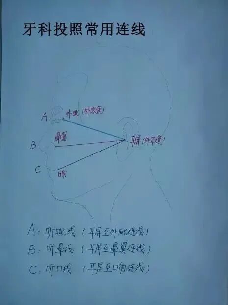 x光机为什么X光机的拍摄技术与心得，牙医和护士都要懂！_https://www.jmylbn.com_新闻资讯_第8张