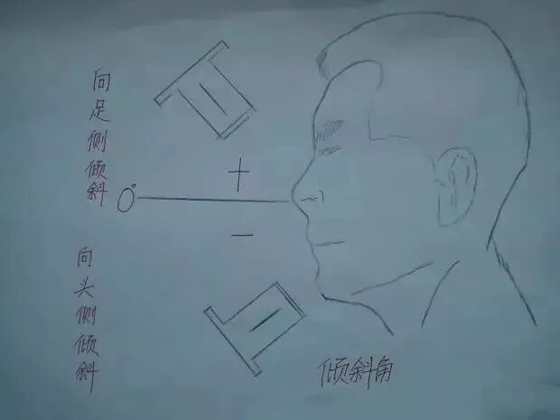 x光机为什么X光机的拍摄技术与心得，牙医和护士都要懂！_https://www.jmylbn.com_新闻资讯_第11张