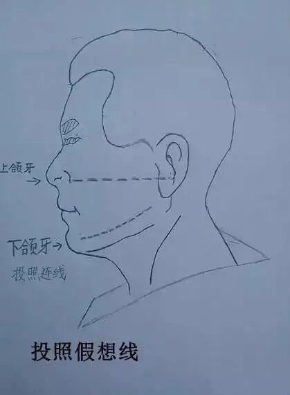 x光机为什么X光机的拍摄技术与心得，牙医和护士都要懂！_https://www.jmylbn.com_新闻资讯_第7张