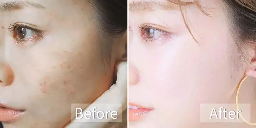 己思 日本赵丽颖 直播间尺度太大遭封杀 无码视频疯传全网 引3000w网友直呼亢奋 鼻血直流