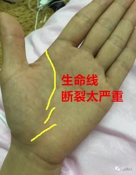 小心了 手上 这里 呈断崖式断裂 38岁有大灾难 必出意外之灾 心情篇 微信公众号文章阅读 Wemp