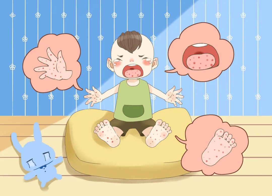 夏季幼儿要注意这5种传染病