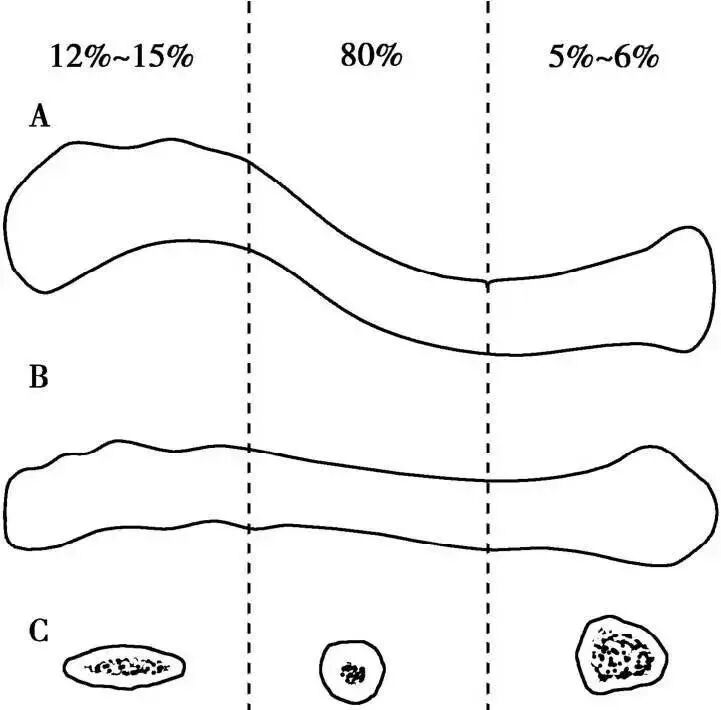 锁骨板有哪些【每周科普】锁骨骨折分中段、外段、内段，治疗方式也有差异_https://www.jmylbn.com_新闻资讯_第3张