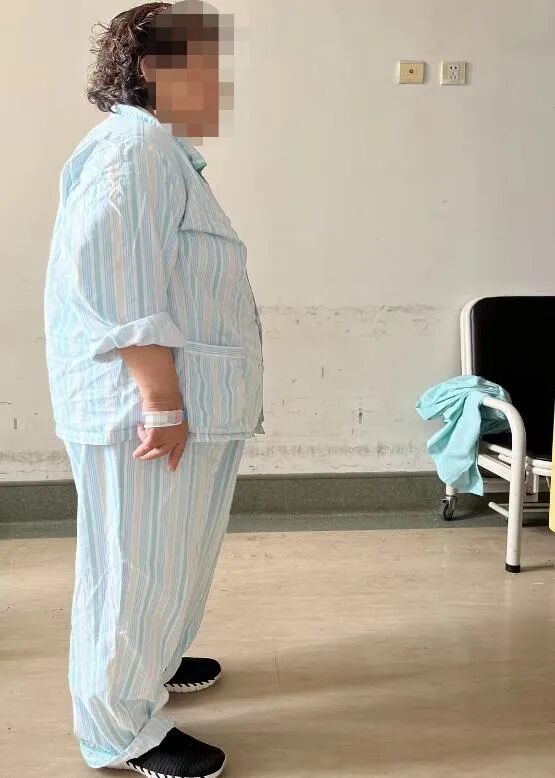 术后朱阿婆可以行走