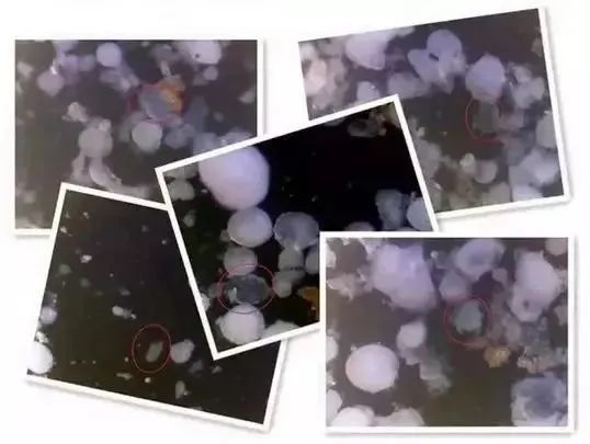 怎么判断是螨虫咬的包_螨虫咬人后症状图片_被子里的螨虫咬人吗