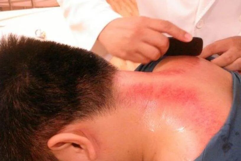 牛角板怎么处理刮痧涨姿势！怎样选好、用好刮痧板？_https://www.jmylbn.com_新闻资讯_第9张