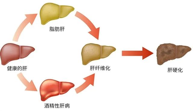 【养生】三十而已:许幻山出轨,败在顾佳不准他吃晚饭? 【养生】三十而已:许幻山出轨,败在顾佳不准他吃晚饭?