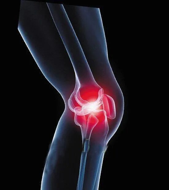 为什么总是膝盖疼痛这些病因很常见