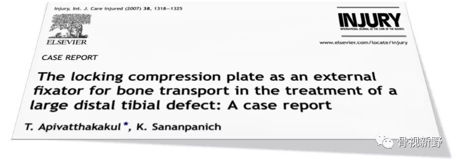 锁定钢板的外固定应用