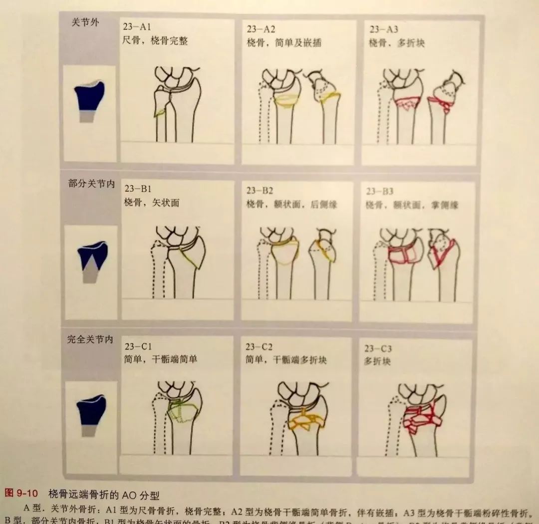 四肢关节组织解剖结构与生理学特点_挂云帆