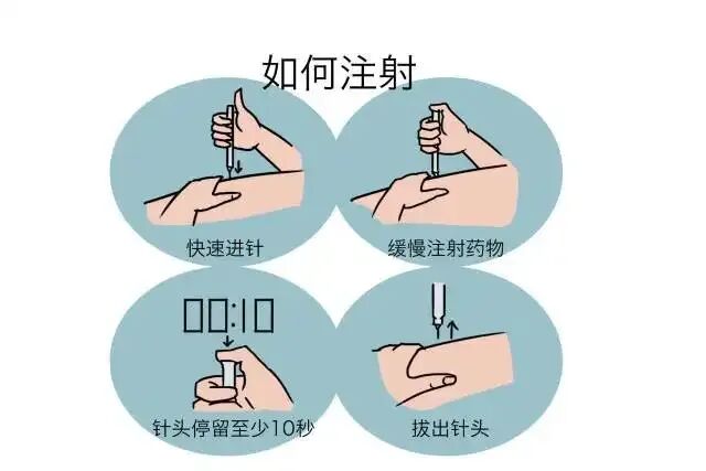 打肝素怎么拔针肝素自行注射指导攻略_https://www.jmylbn.com_新闻资讯_第7张