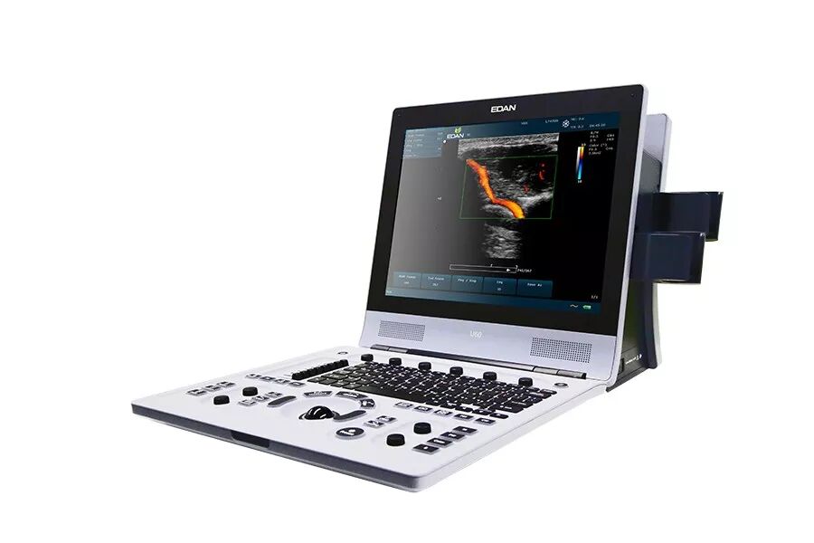 索诺星超声怎么样索诺星和理邦全新彩超机器_https://www.jmylbn.com_新闻资讯_第41张