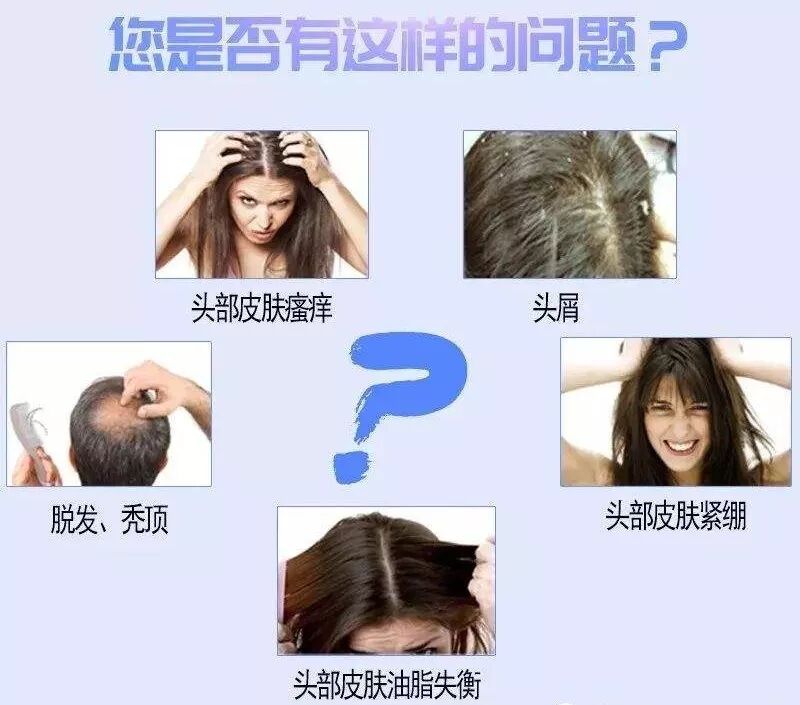 头皮排毒|给头皮减个压