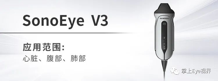凸阵探头包括哪些超声基础 ｜ 探头的构造及工作原理_https://www.jmylbn.com_新闻资讯_第7张