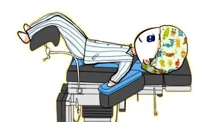 妇科手术床怎么座【健康科普】手术室里的各种“姿势”_https://www.jmylbn.com_新闻资讯_第7张