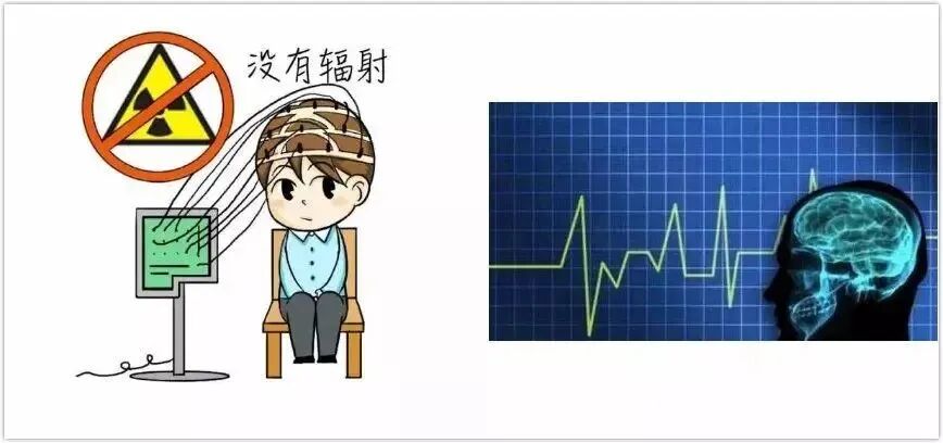 16导脑电图怎么放置长程多导视频脑电图准确捕捉“异常波”的蛛丝马迹 ----- 潢川县人民医院服务能力提升系列报道_https://www.jmylbn.com_新闻资讯_第2张