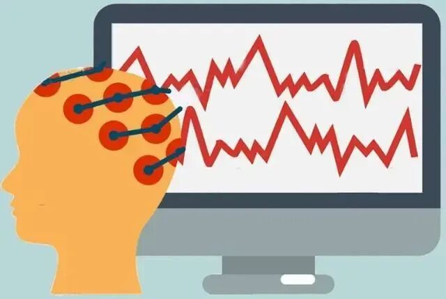 16导脑电图怎么放置长程多导视频脑电图准确捕捉“异常波”的蛛丝马迹 ----- 潢川县人民医院服务能力提升系列报道_https://www.jmylbn.com_新闻资讯_第12张