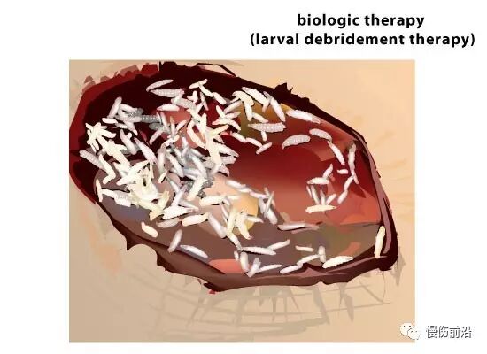 抗菌清创敷料有什么用基础知识：清创在伤口愈合中的重要作用_https://www.jmylbn.com_新闻资讯_第2张