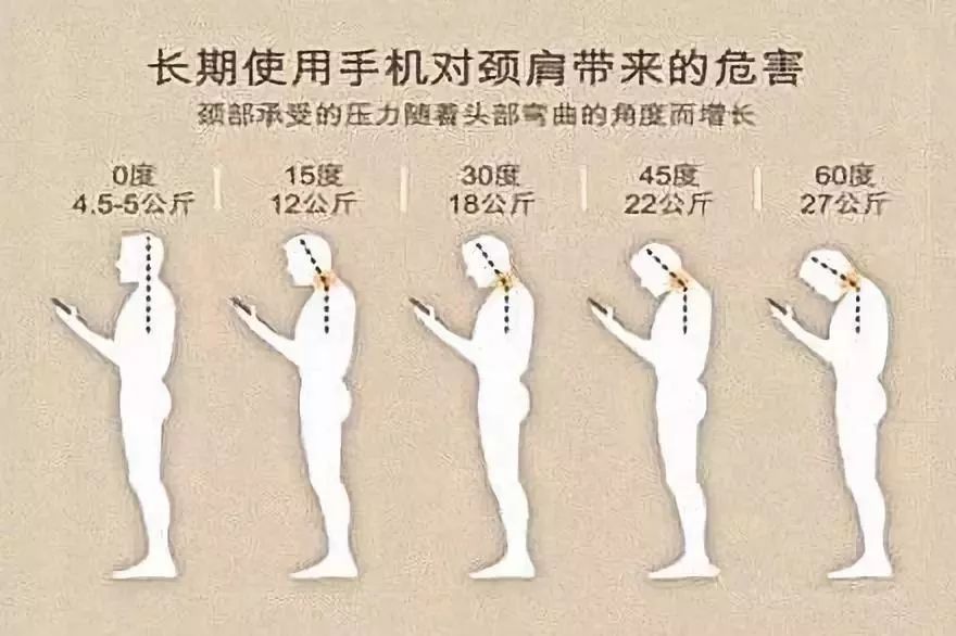 每天玩手機4小時，8年後開刀換骨：頸椎，正在成為中國人的死穴 科技 第5張