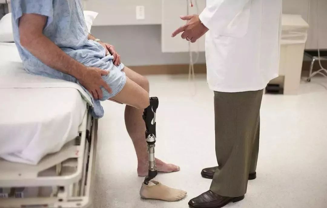 穿戴假肢,你应该知道的保养与维护宝典 穿戴假肢,你应该知道的保养与维护宝典