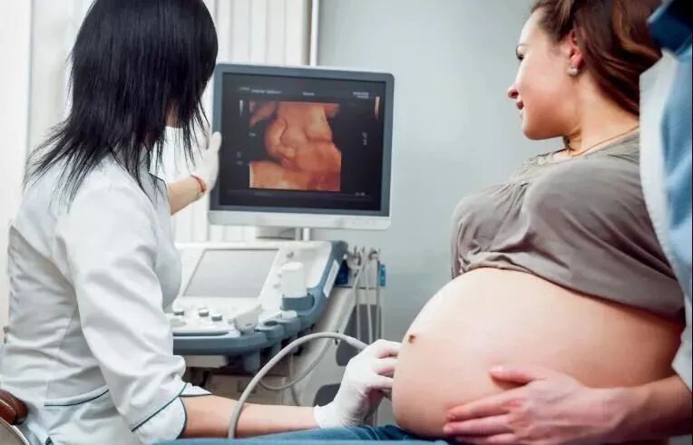 美国彩超怎么购买彩超界的网红—— 美国GE-E10四维彩超，你了解多少_https://www.jmylbn.com_新闻资讯_第11张