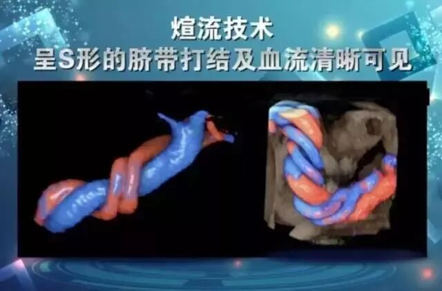 美国彩超怎么购买彩超界的网红—— 美国GE-E10四维彩超，你了解多少_https://www.jmylbn.com_新闻资讯_第8张