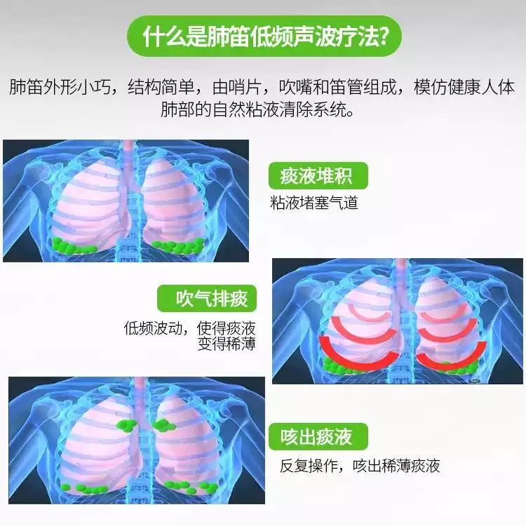 治疗肺部疾病 是消炎 还是排痰 关注肺健康关爱你我他 微信公众号文章阅读 Wemp