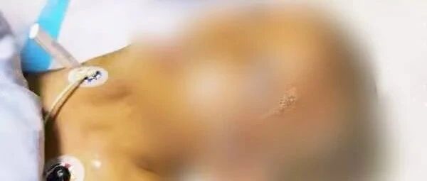 心慌！东莞妈妈用农药给女儿焗发