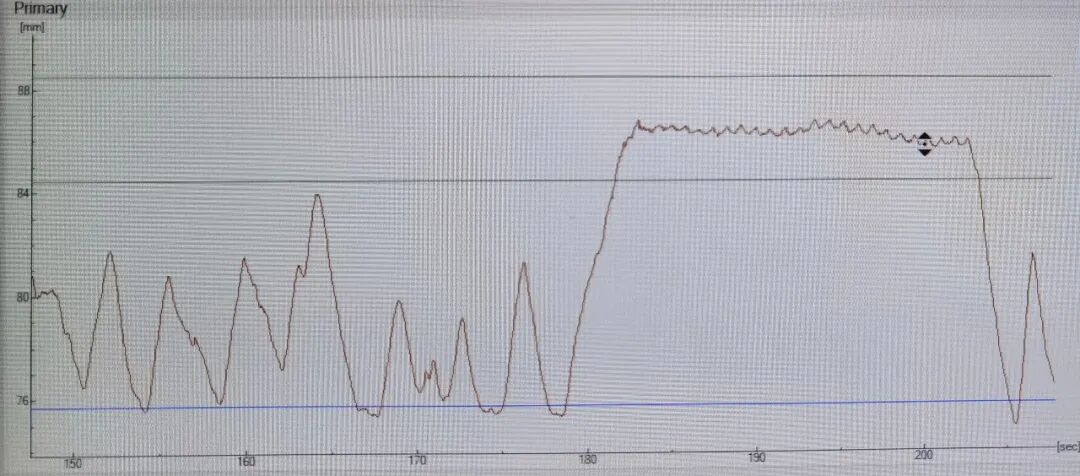 放疗怎么定位放疗知多少 ｜ 乳腺放疗第一步：定位！_https://www.jmylbn.com_新闻资讯_第5张