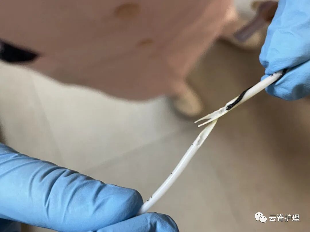 中心静脉导管是什么您颈部的针是什么？--中心静脉导管（CVC）_https://www.jmylbn.com_新闻资讯_第9张