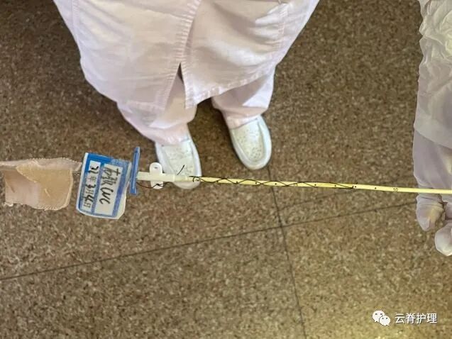 中心静脉导管是什么您颈部的针是什么？--中心静脉导管（CVC）_https://www.jmylbn.com_新闻资讯_第10张