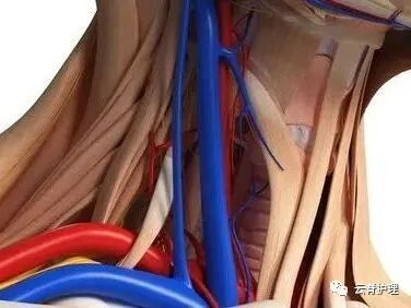 中心静脉导管是什么您颈部的针是什么？--中心静脉导管（CVC）_https://www.jmylbn.com_新闻资讯_第3张