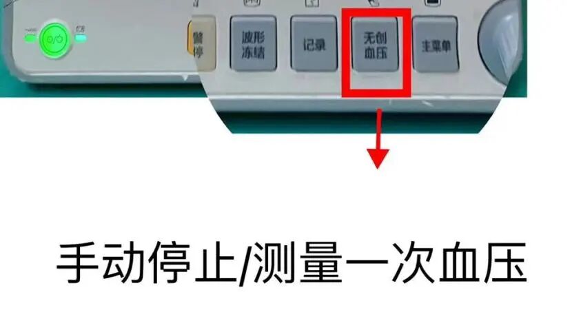 心电监护仪怎么测血压心电监护仪的操作及注意事项，详细又实用【视频+PPT】_https://www.jmylbn.com_新闻资讯_第8张
