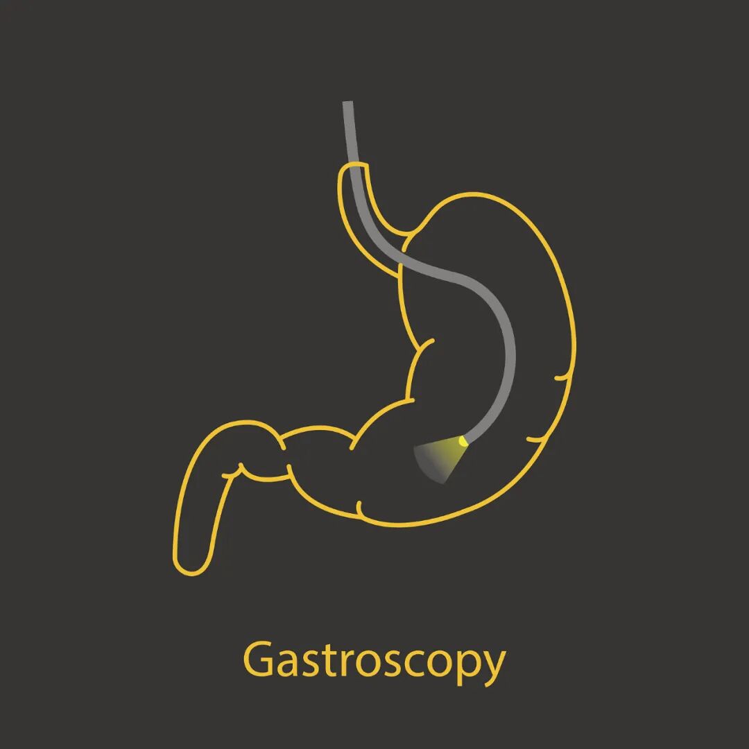 丹麦ambu怎么样【理实原创】江湖变局：一次性内窥镜_https://www.jmylbn.com_新闻资讯_第3张