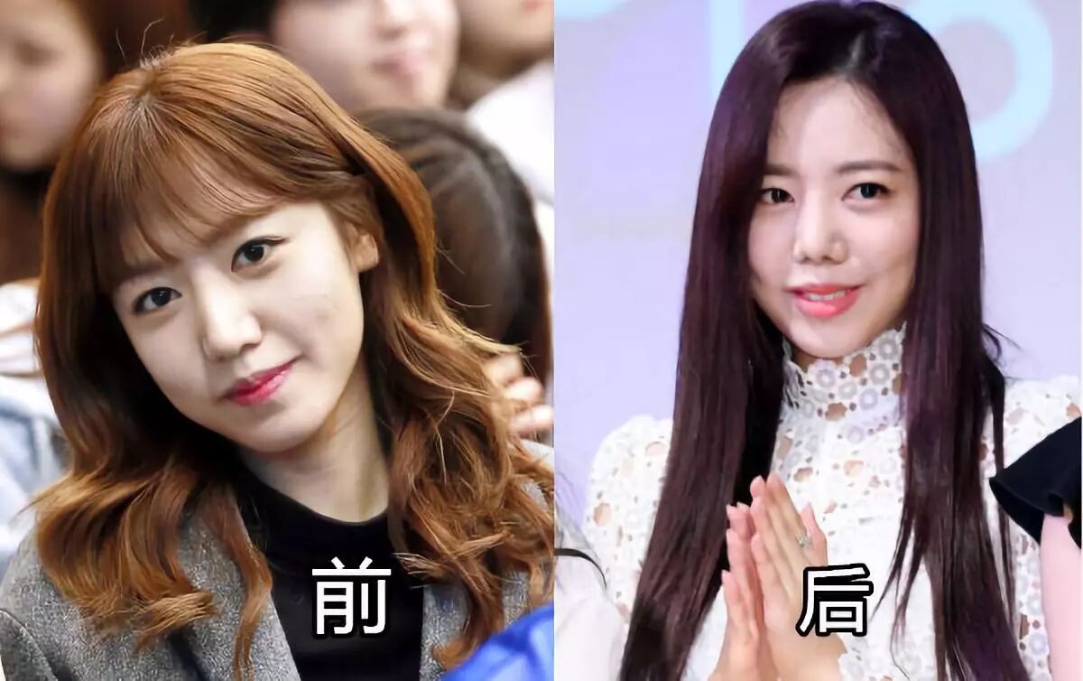 韩国女爱豆整容失败如换头 但该整的 真的是脸蛋儿吗 时尚芭莎 Bazaar中文网