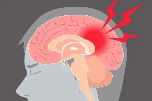 才35岁福州男子急性脑梗死只因