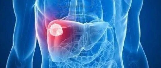 7岁女孩肚子疼,检查已是癌症晚期!医生:祸根在出生时已埋下,父母千万要注意...