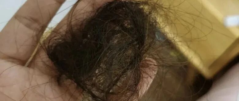 太崩溃!浙江姑娘发帖:还没生孩子就这样了!这种症状越来越年轻化...