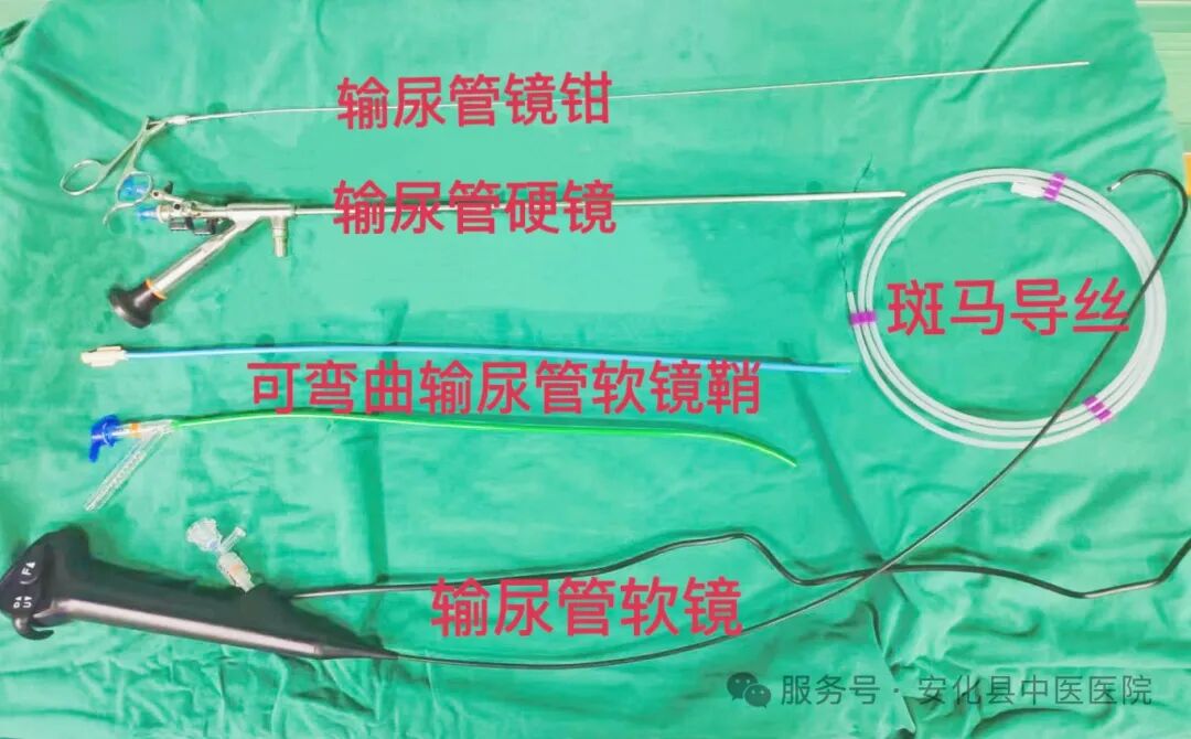 输尿管鞘是什么【技术突破】无创取石新利器——安化县中医医院成功开展可弯曲负压吸引鞘联合输尿管软镜钬激光碎石取石术•“卓越服务”系列报道（十六）_https://www.jmylbn.com_新闻资讯_第5张