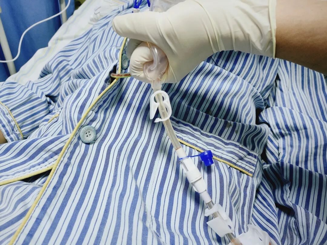 伤口引流袋怎么用保“管”学会——乳腺癌术后带管居家护理_https://www.jmylbn.com_新闻资讯_第12张