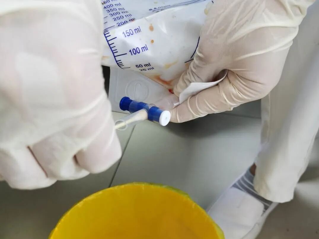 伤口引流袋怎么用保“管”学会——乳腺癌术后带管居家护理_https://www.jmylbn.com_新闻资讯_第18张