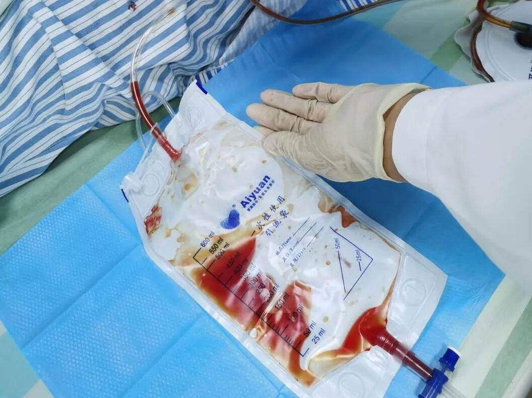 伤口引流袋怎么用保“管”学会——乳腺癌术后带管居家护理_https://www.jmylbn.com_新闻资讯_第13张