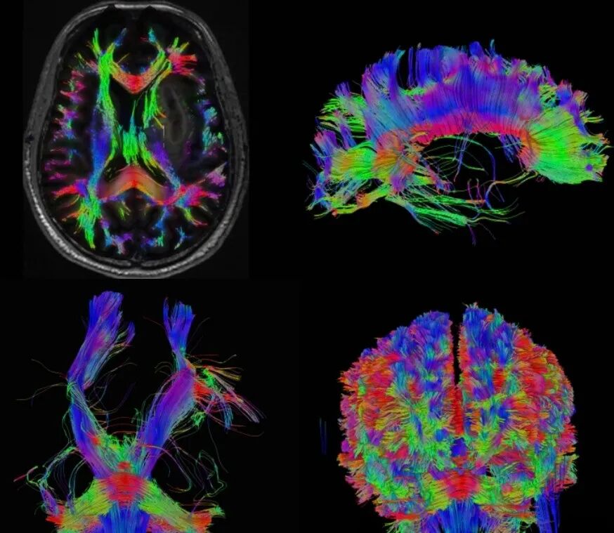 联影磁共振怎么样更先进、更高效、更精准—联影3.0T超导磁共振落户武城县人民医院_https://www.jmylbn.com_新闻资讯_第7张
