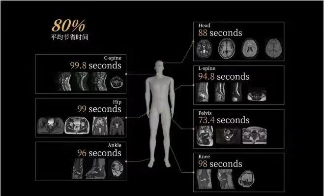 联影磁共振怎么样更先进、更高效、更精准—联影3.0T超导磁共振落户武城县人民医院_https://www.jmylbn.com_新闻资讯_第6张