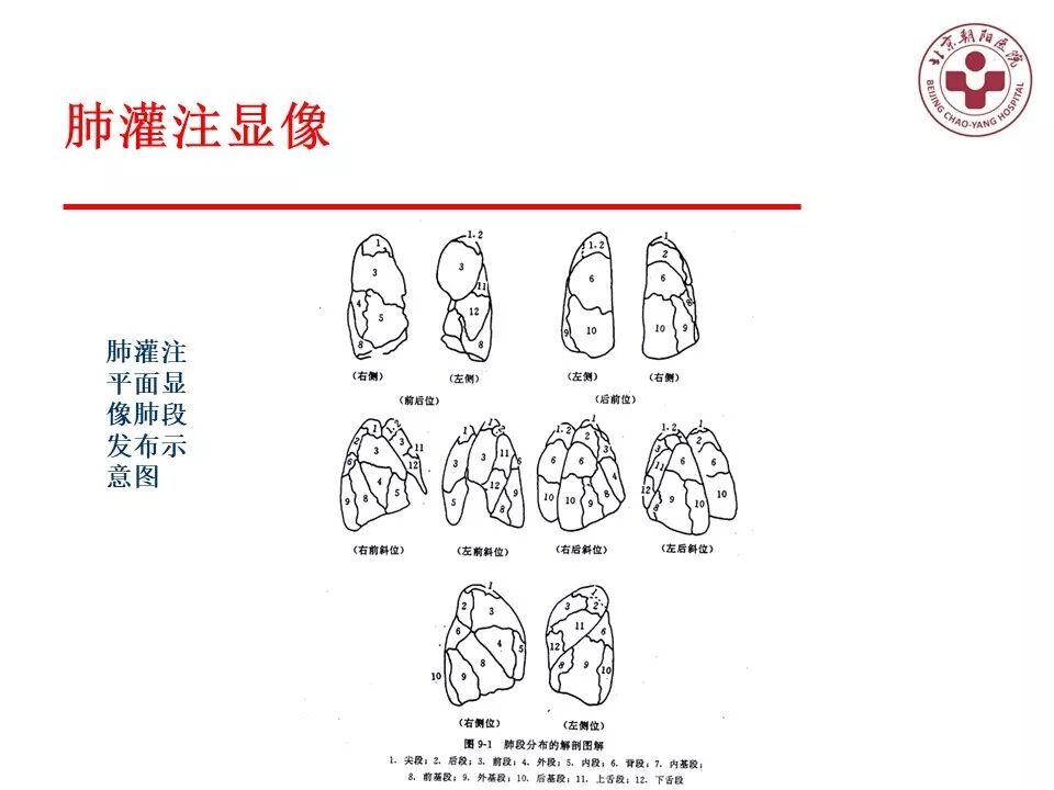 d-spect怎么检查【核汇园】20期：王铁教授 ｜《肺通气-灌注SPECT／CT显像评价肺动脉栓塞》_https://www.jmylbn.com_新闻资讯_第16张
